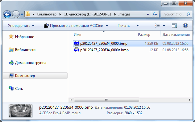 ortopantomogramma_cd_snimki.gif